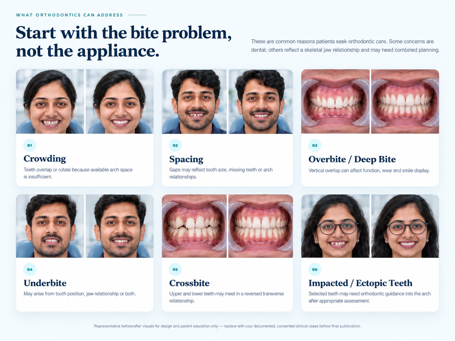 Orthodontic concerns including crowding, spacing, overbite or deep bite, underbite, crossbite and impacted or ectopic teeth